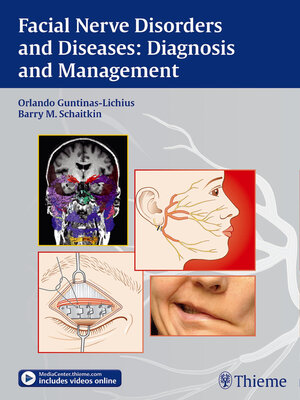 cover image of Facial Nerve Disorders and Diseases